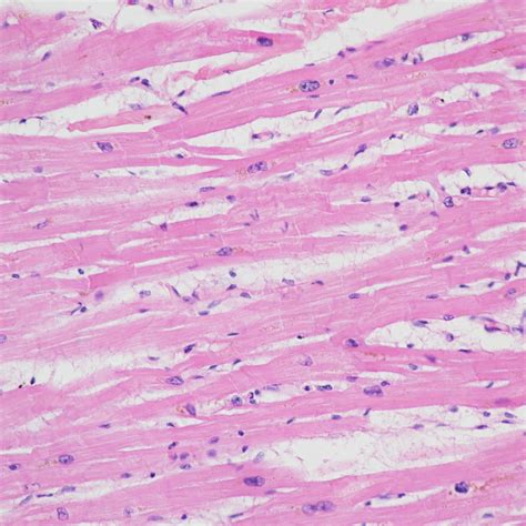 H&E-stained cardiac muscle tissue | Galleries | Nikon Europe B.V.