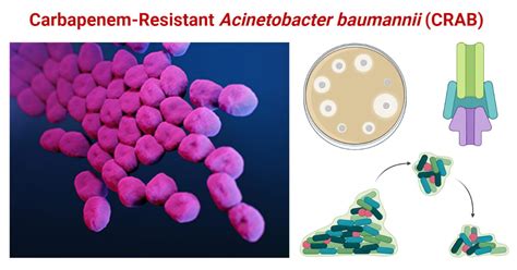 Carbapenem-Resistant Acinetobacter baumannii (CRAB)