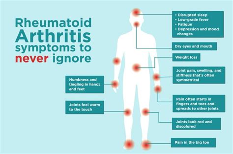 rheumatoid arthritis - Google Search | Rheumatoid arthritis symptoms ...