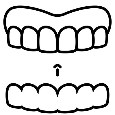 The Benefits of Invisalign Braces | Pitt Street Dental Centre