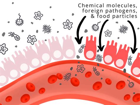 Don't Ignore These Signs of a Leaky Gut - The Functional Medicine MD