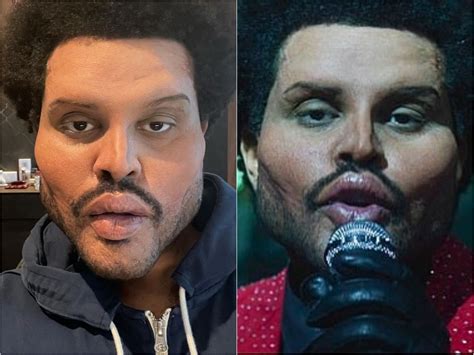 What happened to The Weeknd’s face? Singer removes…