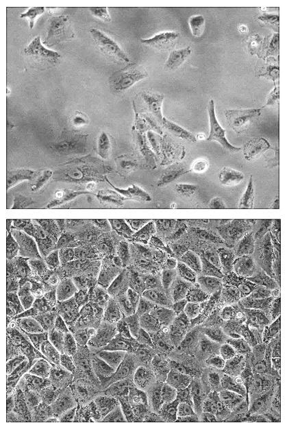 A549-hNIS-Neo Reporter Gene Cell Line - Imanis Life Sciences