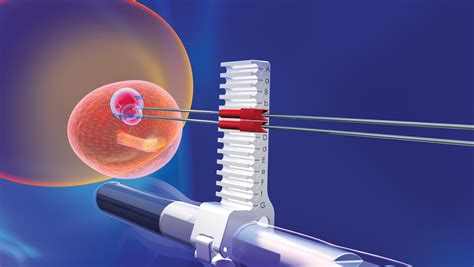 Targeted Prostate Biopsy - Olympic Diagnostic