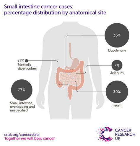 Small intestine cancer incidence statistics | Cancer Research UK