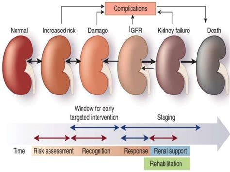 Acute kidney injury