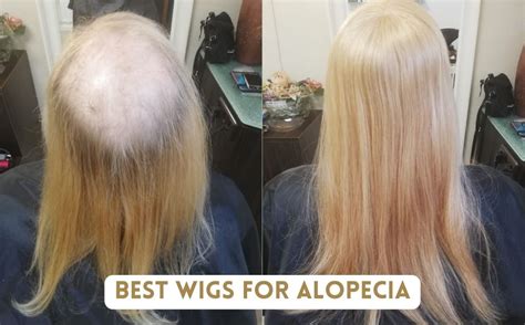 Best Wigs and Toppers for Alopecia and Women's Hair Loss