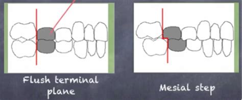 *Development of occlusion Flashcards | Quizlet