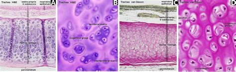 Tracheal Cartilage Histology