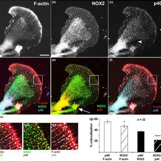 40phox colocalizes with F-actin bundles. (a) Aplysia growth cone... | Download Scientific Diagram