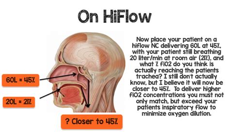 Cureus | High-flow Nasal Cannula: Mechanisms of Action and Adult and Pediatric Indications