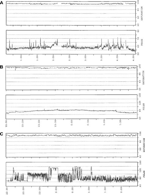 Overnight Pulse Oximetry Interpretation - Nursing Resource Center