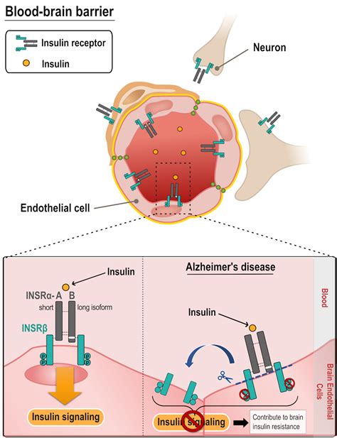 Why does the Alzheimer’s brain become insulin-resistant? - Raw Story