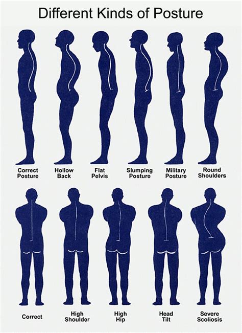 Posture Fix, Posture Exercises, Bad Posture, Better Posture, Poor Posture, Improve Posture ...