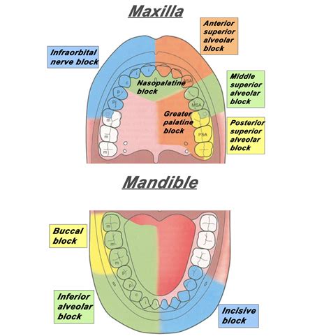 Week Maxillary Nerve V Anesthesia And Mandibular V Nerve | My XXX Hot Girl