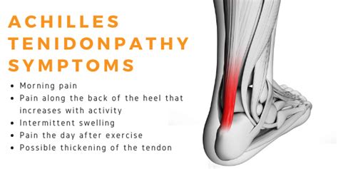 achilles tendinopathy - Propel Physiotherapy