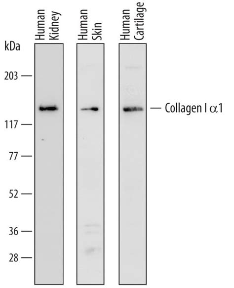 Human Pro Collagen I alpha 1 Antibody AF6220: R&D Systems