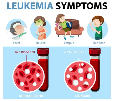 Leukemia