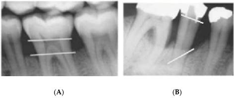 Dentistry Journal | Free Full-Text | Development of a Radiographic ...