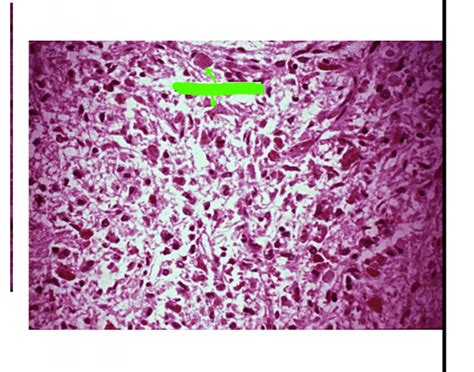 Pars nervosa histology Quiz