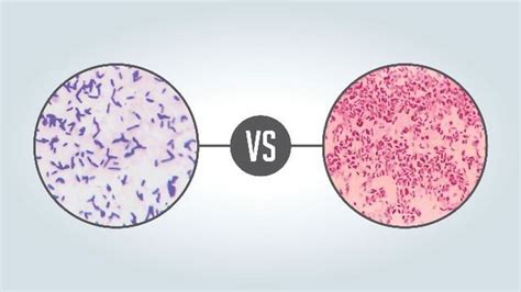 Gram Positive vs Gram Negative | Technology Networks