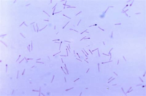 Free picture: colony, clostridium gram, positive, bacteria, grown ...