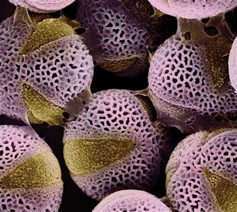 Plant seeds under electron microscope - Pollen of Helleborus orientalis vs Lenten rose | Seed ...