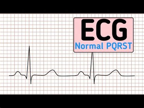 Normal ECG में pqrst wave क्या है? कैसे बनती हैं? और इनका क्या अर्थ है ...