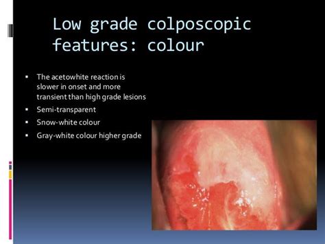 2 prof james bently differentiating high and low grade