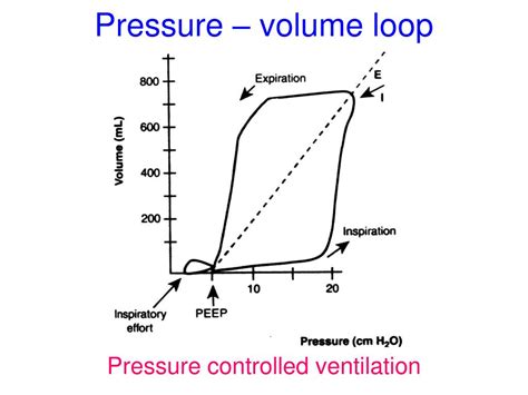 PPT - Interpretation of Ventilator Graphics PowerPoint Presentation - ID:232693