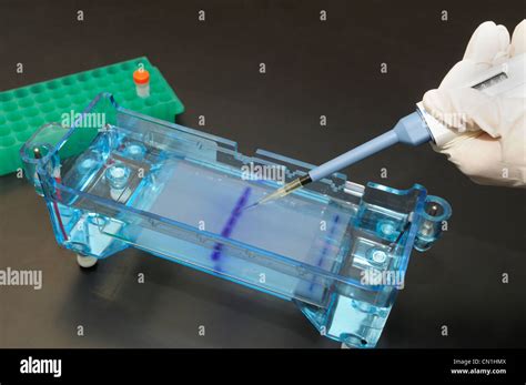 Dna Gel Electrophoresis Procedure