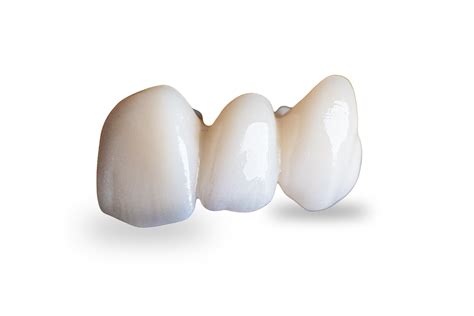 Zirconia crown cementation | Dandy