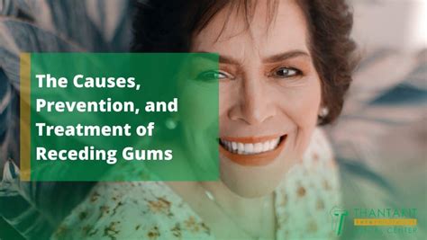 The Causes, Prevention, and Treatment of Receding Gums