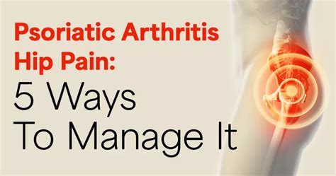 Psoriatic Arthritis Hip Pain: 5 Ways To Manage It | MyPsoriasisTeam