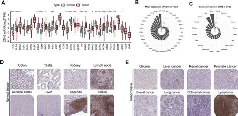 CD45 expression profiles in human normal and tumor tissues. (A ...