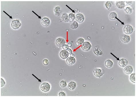 Candida In Urine