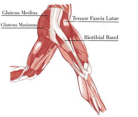 Hip Pain and the Sneaky Tensor Fasciae Latae