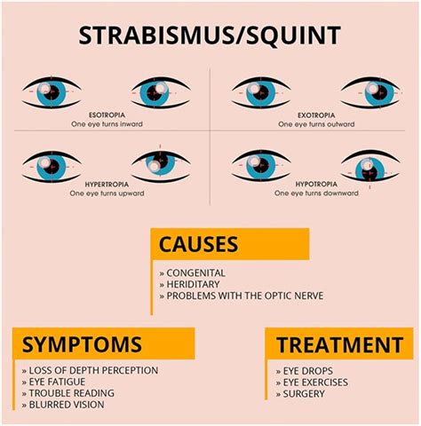 Strabismus - Ananthaksha Super Speciality Eye Hospital