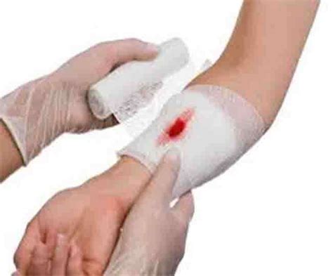 Bandage that can tell about the situation of wound without open it