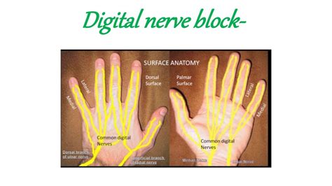 Peripheral Nerve block(ankle block,wrist block, digital block)