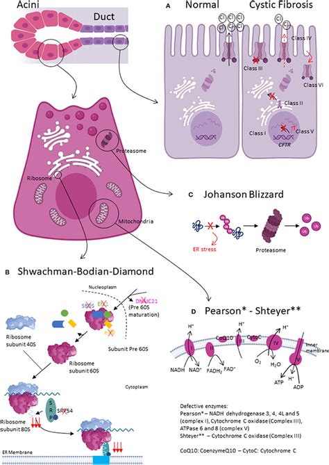 Frontiers | Congenital etiologies of exocrine pancreatic insufficiency