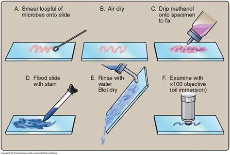 simple staining procedure - Google Search | Microbiology! | Pinterest | Simple and Search