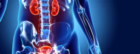 Intravenous pyelogram