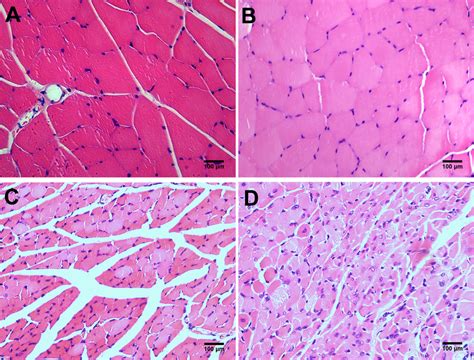 H&E staining of the tibialis anterior muscles 28 days post-surgery. The... | Download Scientific ...