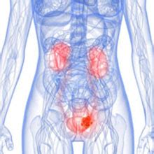 Bruised Kidney | Kidney Contusion | Treatment