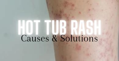 Hot Tub Rash – Causes and Solutions - As Chemical Free as your Spa Can Be