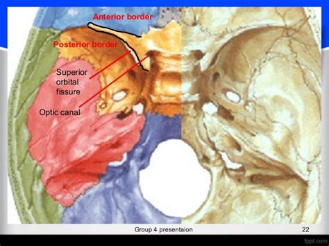 Sphenoid bone (osteology)