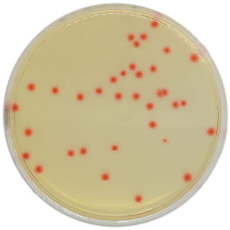 Clostridium Perfringens Colony