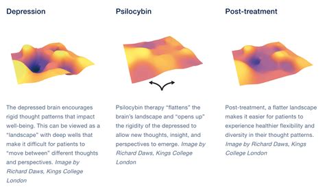 Psilocybin rewires the brain for people with depression | University of ...