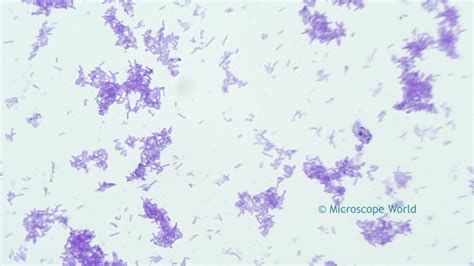 Microscope World Blog: Tetanus Bacteria Under the Microscope